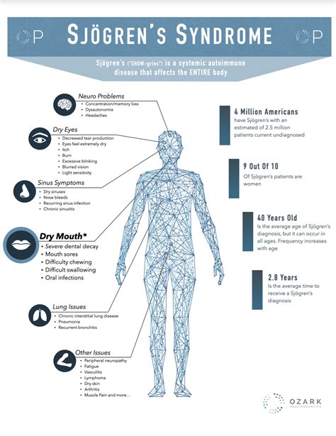 surgery for sjogren's syndrome